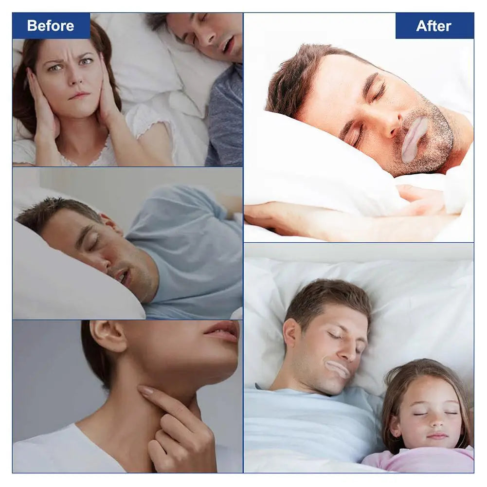 Mouth Tape Sleep Strip For Anti-snoring Mouth Breathing Tape